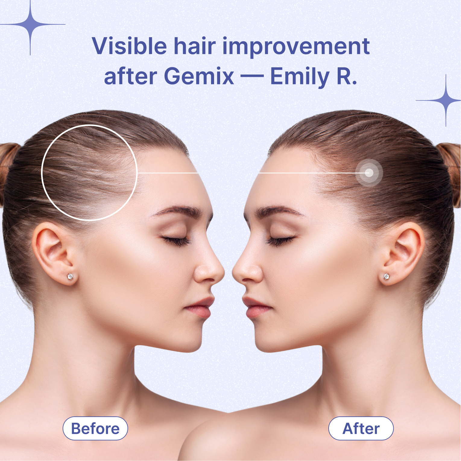 Gemix – Advanced Hair Supplement